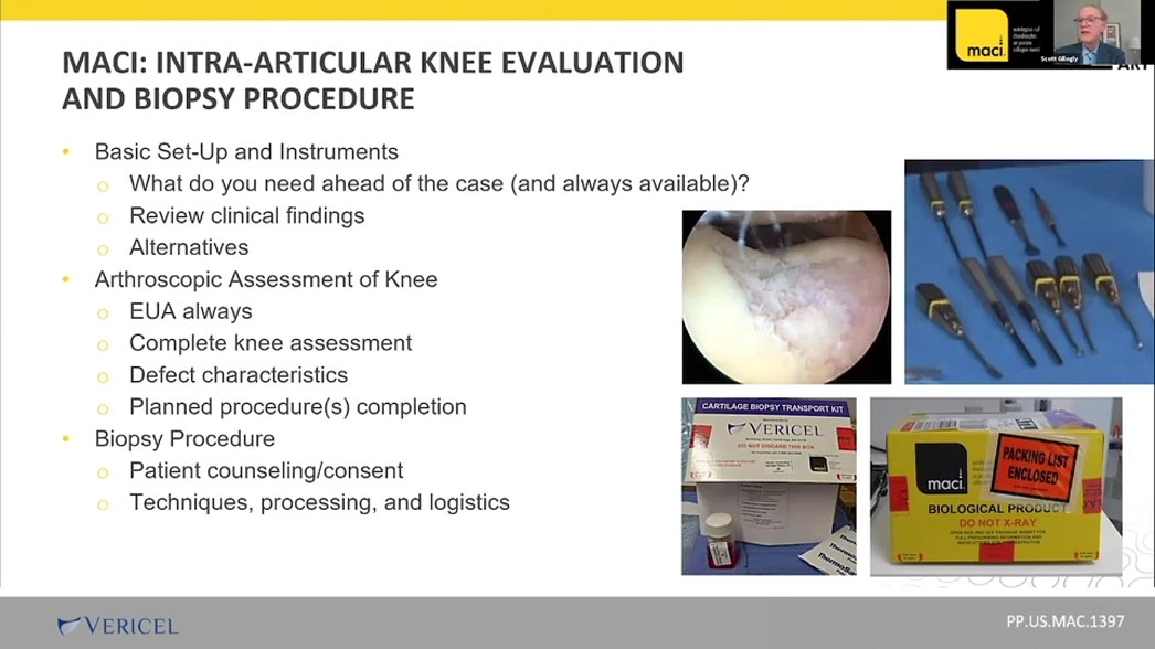 Art of Arthroscopy: Find Guidance for Intra-Articular Knee Evaluation and Biopsy