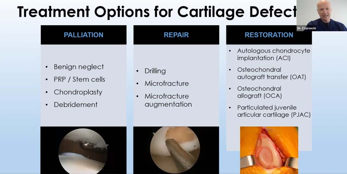 Treatment Options for Cartilage Defects